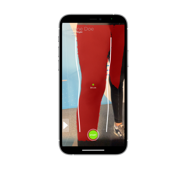 Leg scan iphone